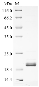 Human G6PC Protein