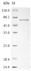 Human MAGEC2 Protein