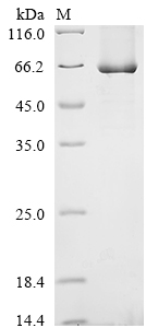 Rat Grin1 Protein