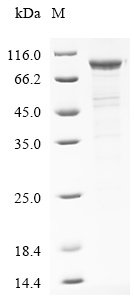 Human EPB41L5 Protein