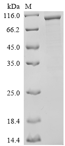 Human POLQ Protein