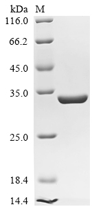 Bacillus velezensis UCMB5033 Chitosanase Protein