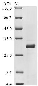 Bothrops atrox Zinc metalloproteinase atroxlysin-1 Protein