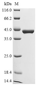 Human L-serine dehydratase/L-threonine deaminase Protein