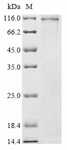 Human Sucrase-isomaltase, intestinal Protein