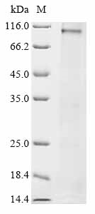 Human SLC26A4 Protein