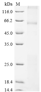 Human MCOLN1 Protein