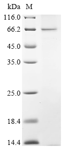 Human Endogenous retrovirus group K member 7 Env polyprotein Protein