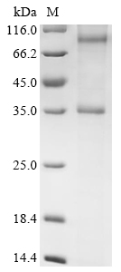 Rat Cmklr2 Protein