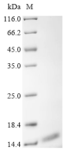 Human ATP5J2 Protein
