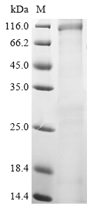 PKH_133110 Protein
