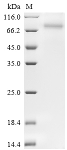Human SLC23A2 Protein