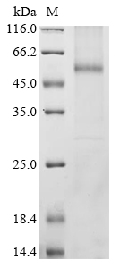 Human SLC2A9 Protein