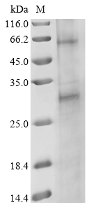 nad2 Protein