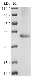 Rat Slc25a18 Protein