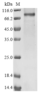 Rat Kcnn2 Protein