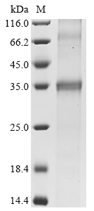 Human SLC14A1 Protein