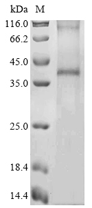 Human RHCE Protein