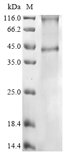 Human RhCE Protein