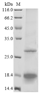 GP2b Protein