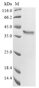 Human GPR62 Protein