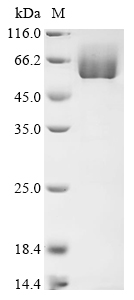 Human MAPK1IP1L Protein