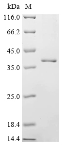 Human ANO5 Protein
