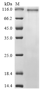 Human PCDH19 Protein