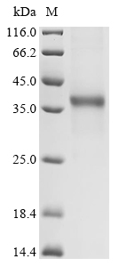 Dendroaspis polylepis polylepis Kunitz-type serine protease inhibitor dendrotoxin E Protein