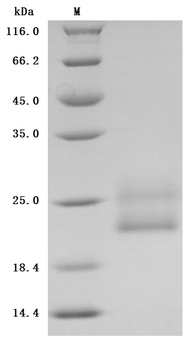Human CD69 Protein