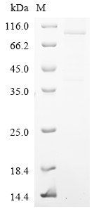 Human EPB41L5 Protein