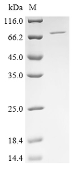 Human PARP2 Protein