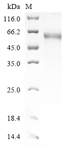 Human TSHR Protein