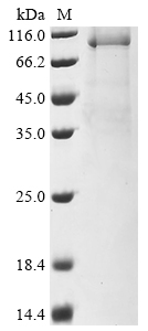 Human POLQ Protein