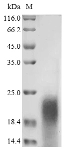 Macrovipera lebetina obtusa Disintegrin obtustatin Protein