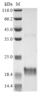 Daboia palaestinae Disintegrin viperistatin Protein