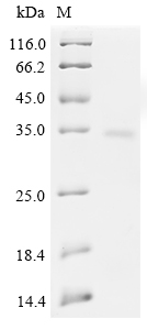 Rat Metrnl Protein