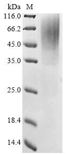 Mouse Rtn3 Protein