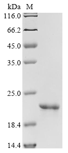 Human GKN1 Protein