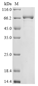 Human ZC3H12A Protein