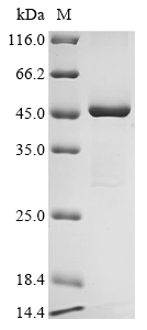 Human FECH Protein