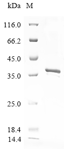 Rift valley fever virus Non-structural protein NS-S Protein