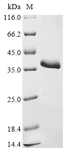 Mouse Timp4 Protein