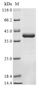 Human CELA2B Protein