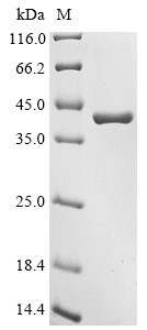 Human PPP2CA Protein