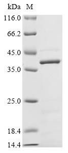 Human CHRM5 Protein