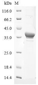 Human PARP2 Protein