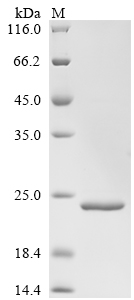 Legionella pneumophila subsp. pneumophila 50S ribosomal protein L7/L12 Protein