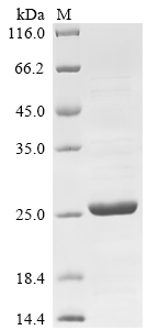 Mouse Rab44 Protein