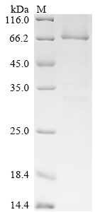 Human adenovirus C serotype 5 E1B 55 kDa Protein